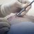 FUE Hair Transplant arreglando los injertos